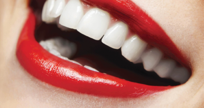 [Chỉ từ 30K] LẤY CAO RĂNG + ĐÁNH BÓNG BẰNG MÁY SIÊU ÂM